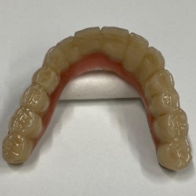 2. Individuell gefertigter Zahnersatz